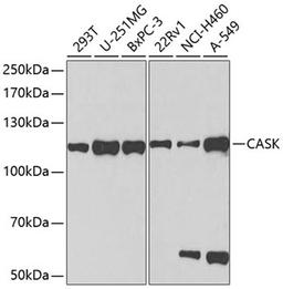 Western blot - CASK antibody (A2501)