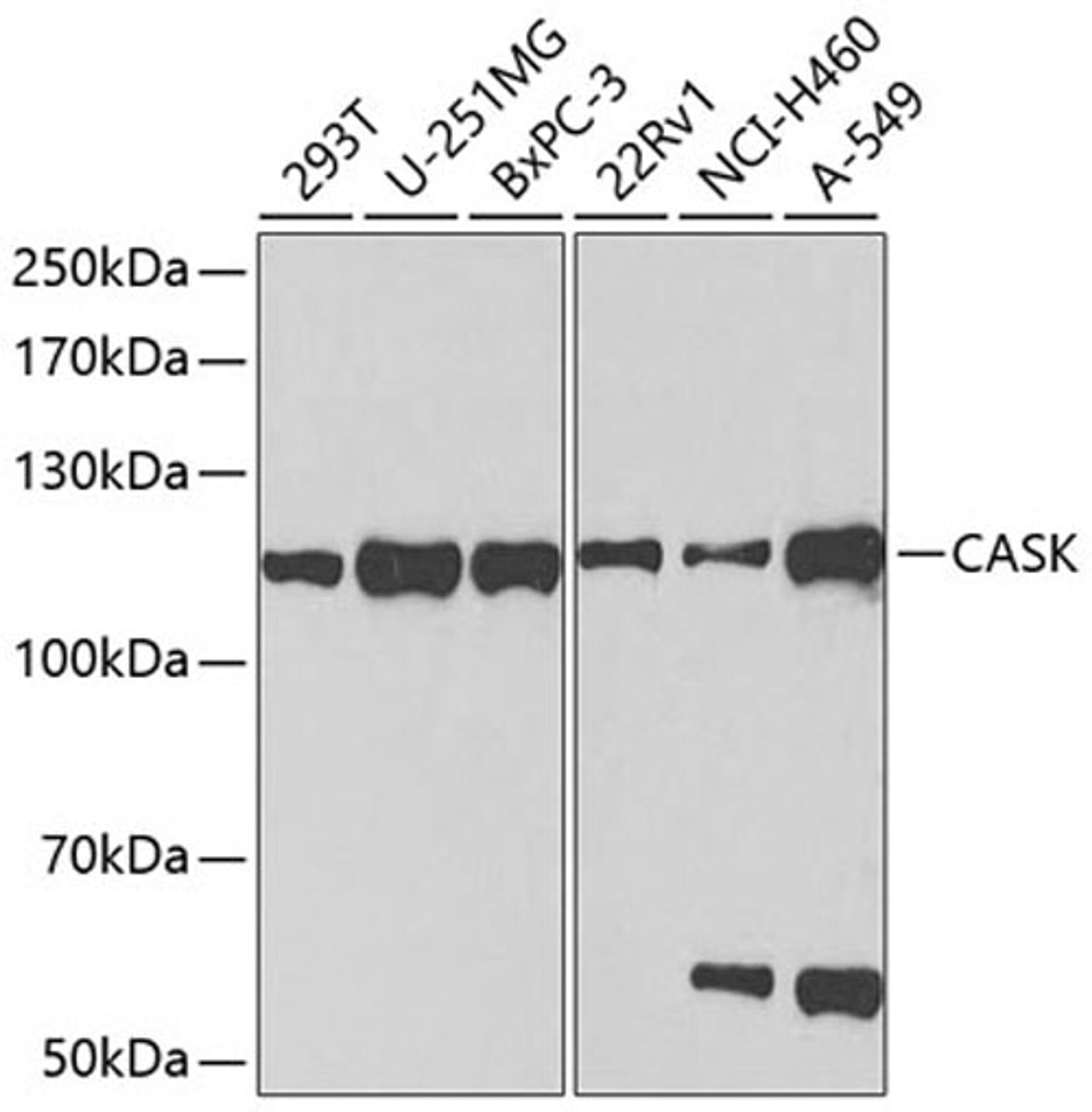 Western blot - CASK antibody (A2501)