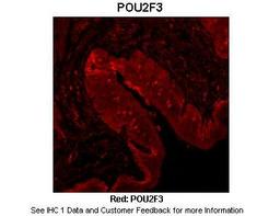 Antibody used in IHC on Mouse tongue at 1:100.