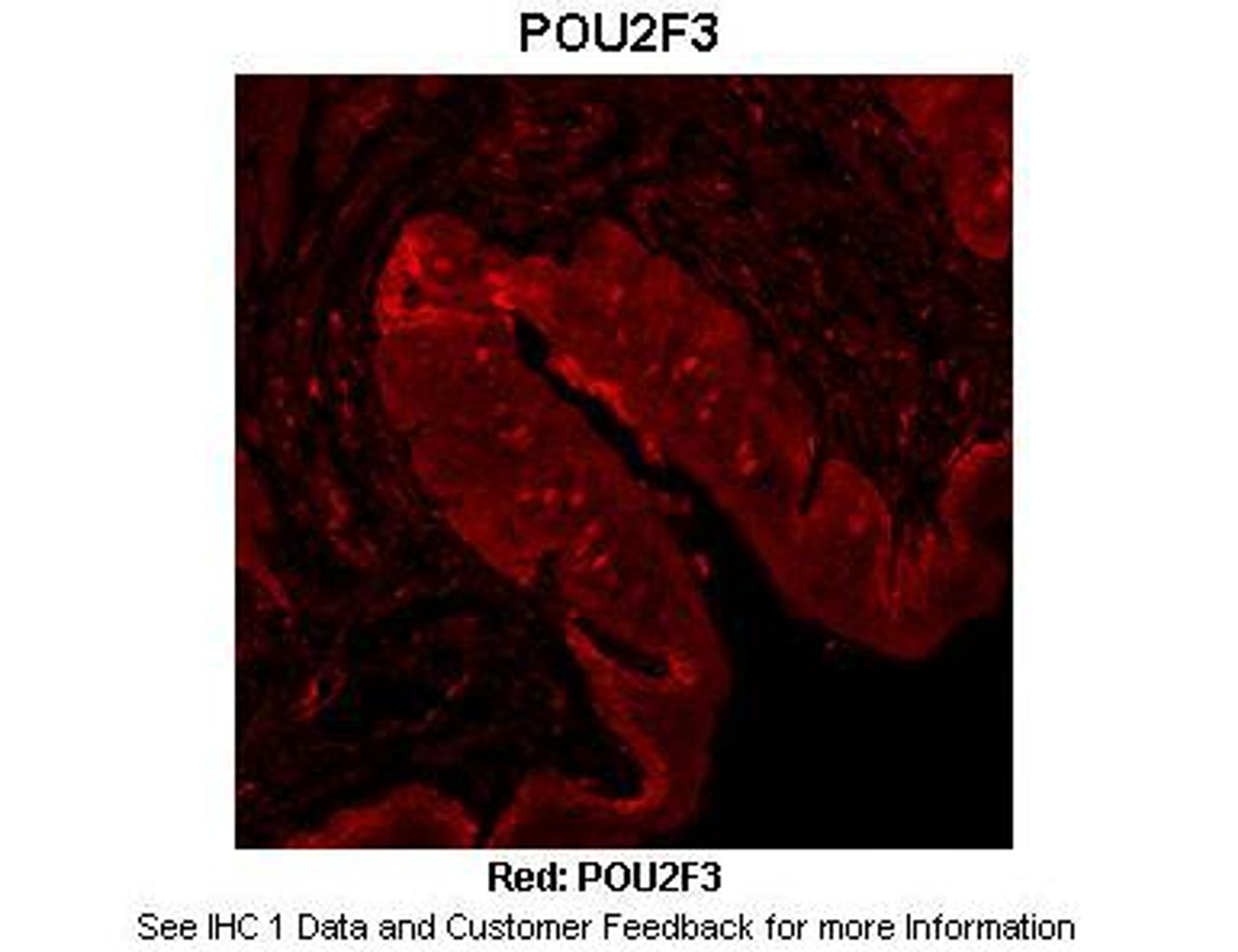 Antibody used in IHC on Mouse tongue at 1:100.