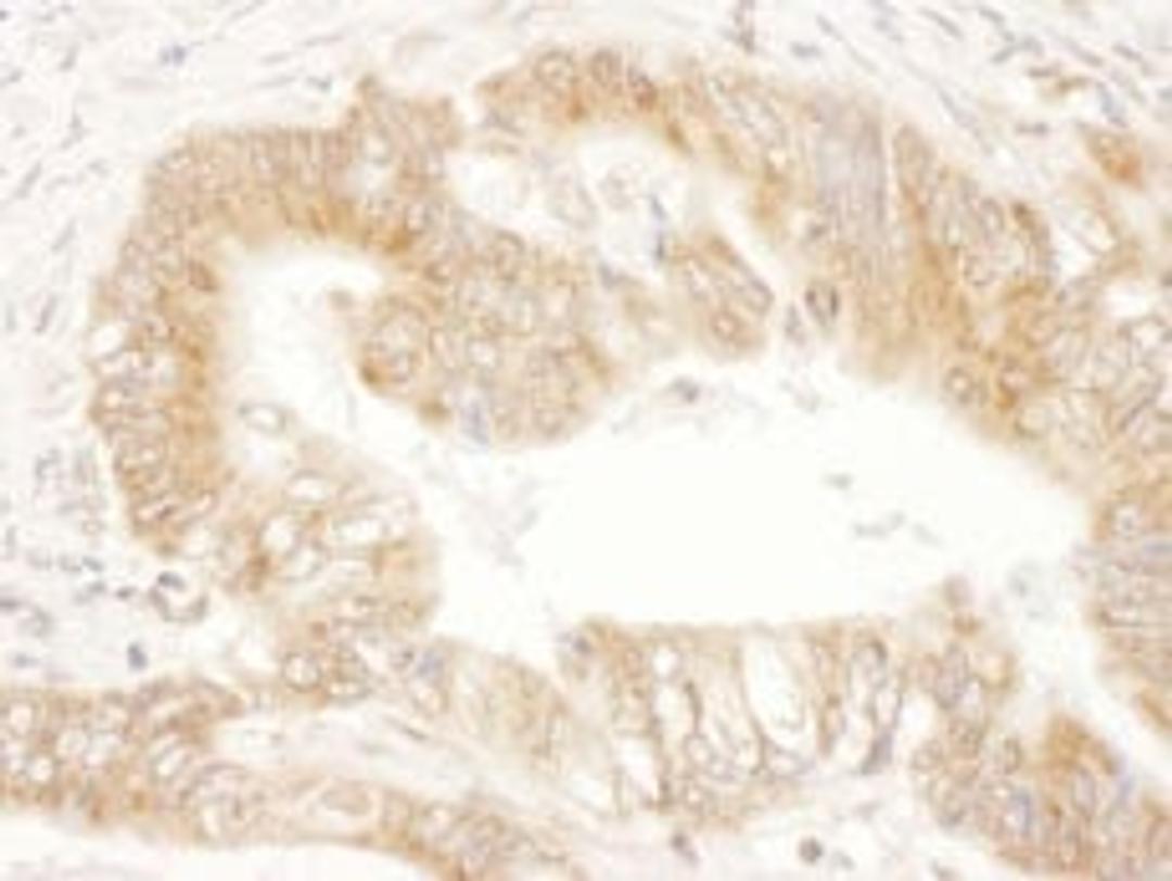 Detection of human CaMKK2 by immunohistochemistry.