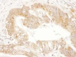 Detection of human CaMKK2 by immunohistochemistry.