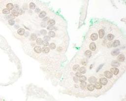 Detection of human ARA70 by immunohistochemistry.