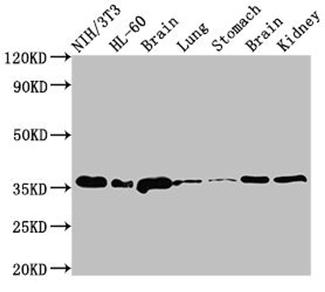 Western Blot. Positive WB detected in: NIH/3T3 whole cell lysate, HL60 whole cell lysate, Rat brain tissue, Rat lung tissue, Rat stomach tissue, Mouse brain tissue, Mouse kidney tissue. All lanes: JUN antibody at 3µg/ml. Secondary. Goat polyclonal to rabbit IgG at 1/50000 dilution. Predicted band size: 36 kDa. Observed band size: 36 kDa