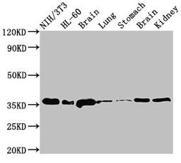 Western Blot. Positive WB detected in: NIH/3T3 whole cell lysate, HL60 whole cell lysate, Rat brain tissue, Rat lung tissue, Rat stomach tissue, Mouse brain tissue, Mouse kidney tissue. All lanes: JUN antibody at 3µg/ml. Secondary. Goat polyclonal to rabbit IgG at 1/50000 dilution. Predicted band size: 36 kDa. Observed band size: 36 kDa