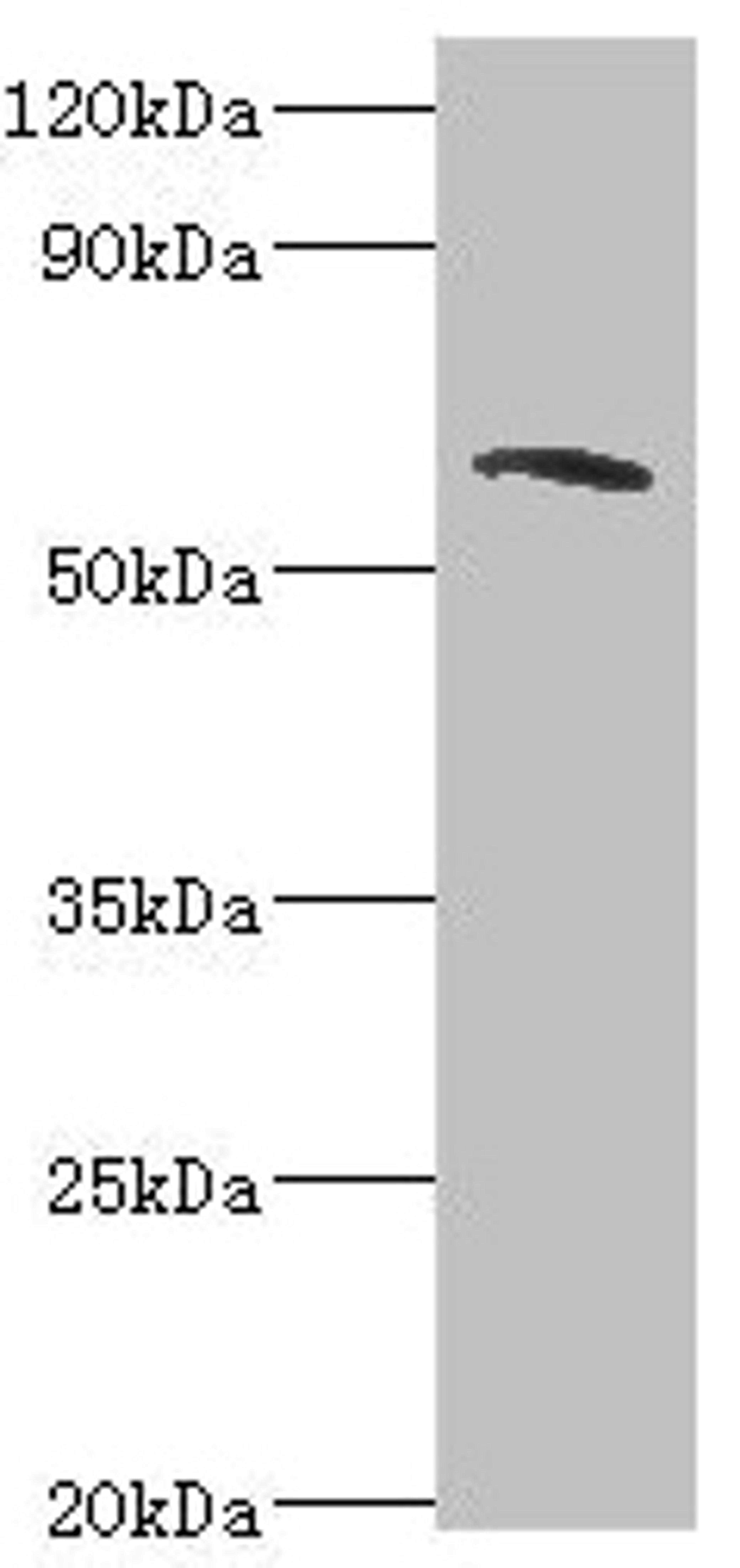Western blot. All lanes: TOMM70A antibody at 6µg/ml + MCF-7 whole cell lysate. Secondary. Goat polyclonal to rabbit IgG at 1/10000 dilution. Predicted band size: 67 kDa. Observed band size: 67 kDa