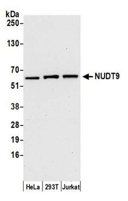 Detection of human NUDT9 by WB.