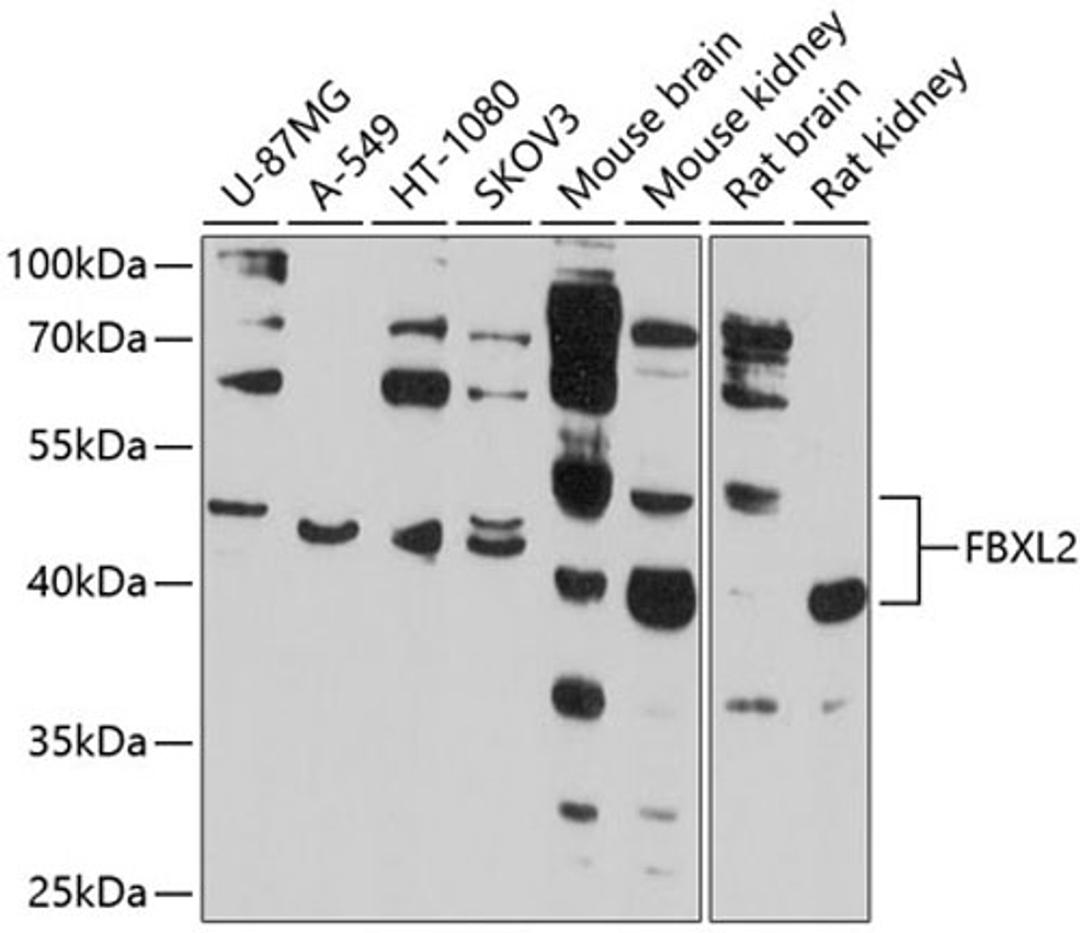 Western blot - FBXL2 antibody (A10296)