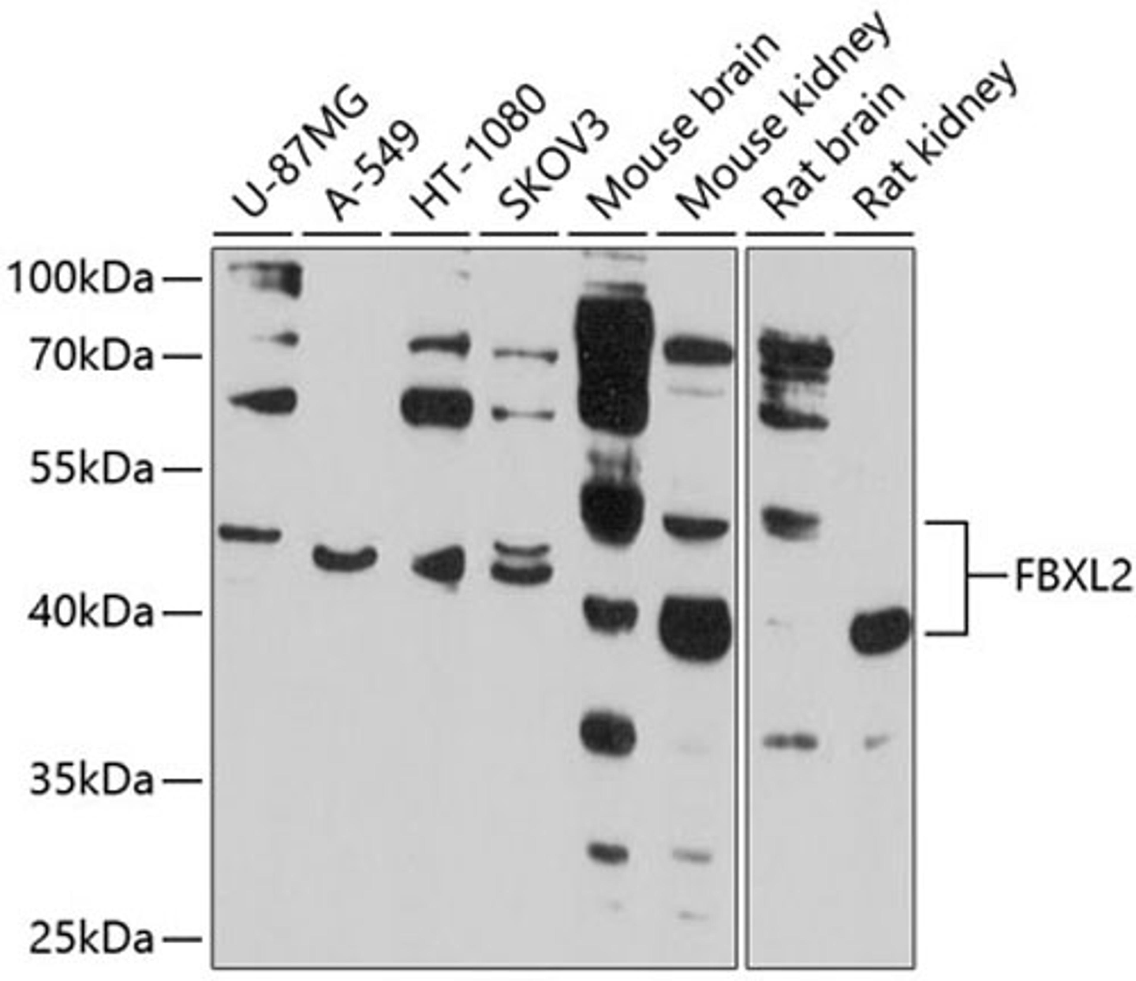 Western blot - FBXL2 antibody (A10296)