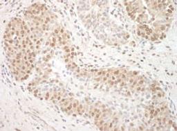 Detection of human TFIP11 by immunohistochemistry.