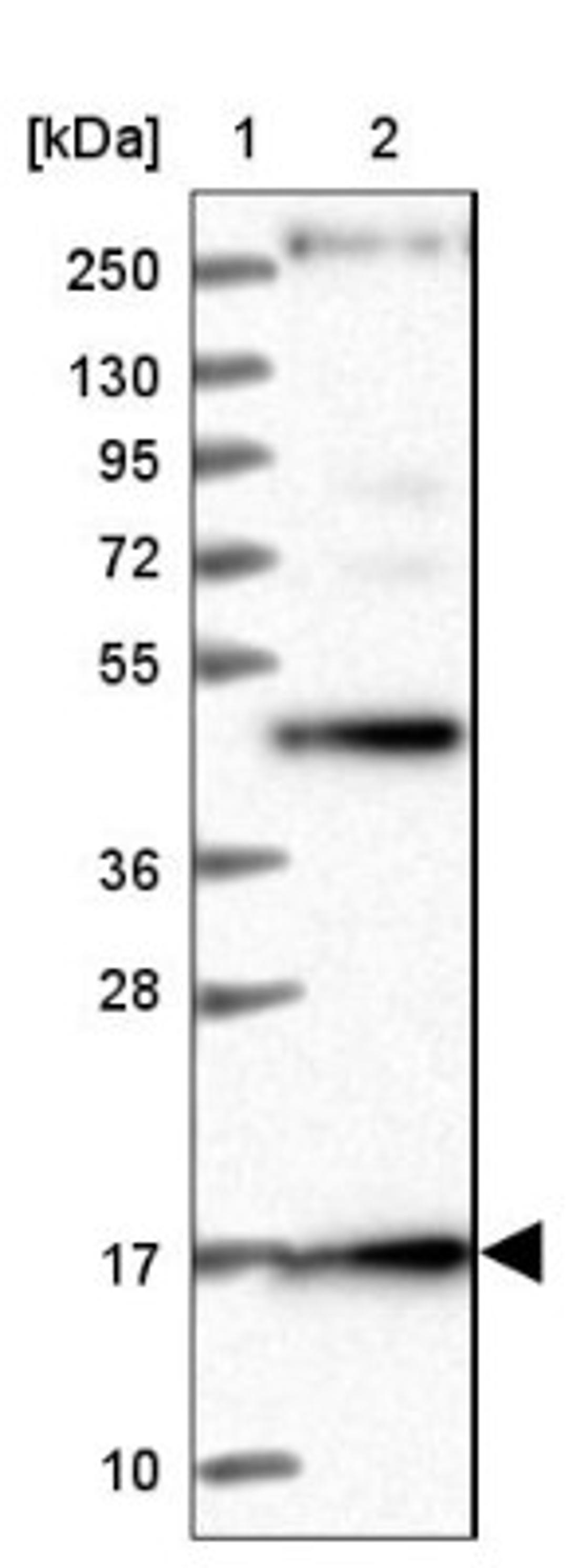 Western Blot: RPS19BP1 Antibody [NBP1-83617] - Lane 1: Marker [kDa] 250, 130, 95, 72, 55, 36, 28, 17, 10<br/>Lane 2: Human cell line RT-4