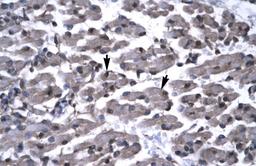 Antibody used in IHC on Human Muscle.