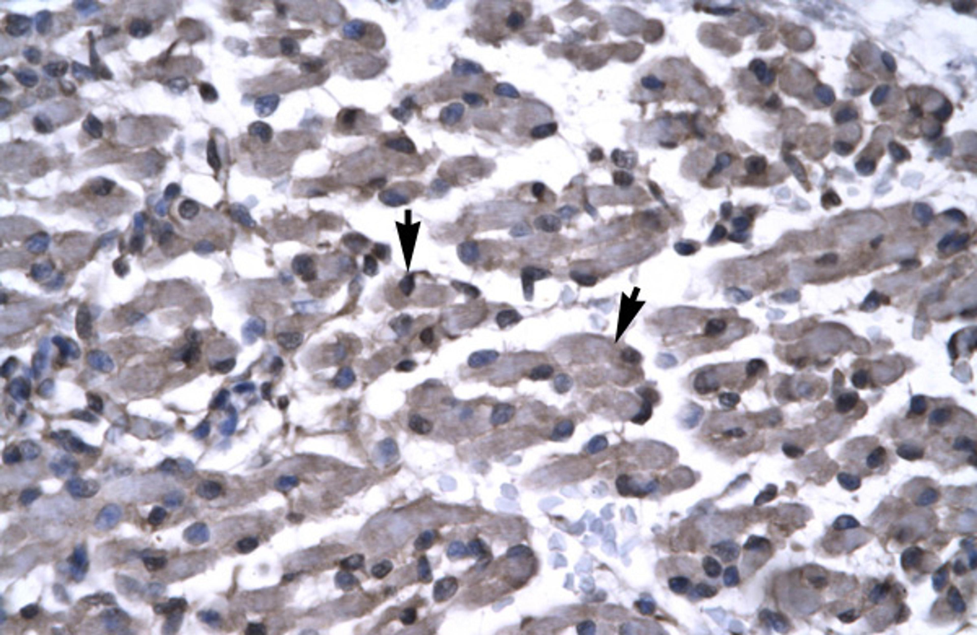 Antibody used in IHC on Human Muscle.