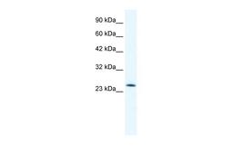 Antibody used in WB on Human Jurkat cells at 0.2-1 ug/ml.