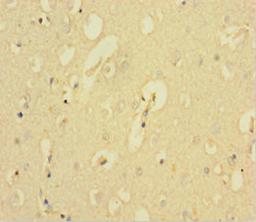 Immunohistochemistry of paraffin-embedded human brain tissue using CSB-PA614255LA01HU at dilution of 1:100