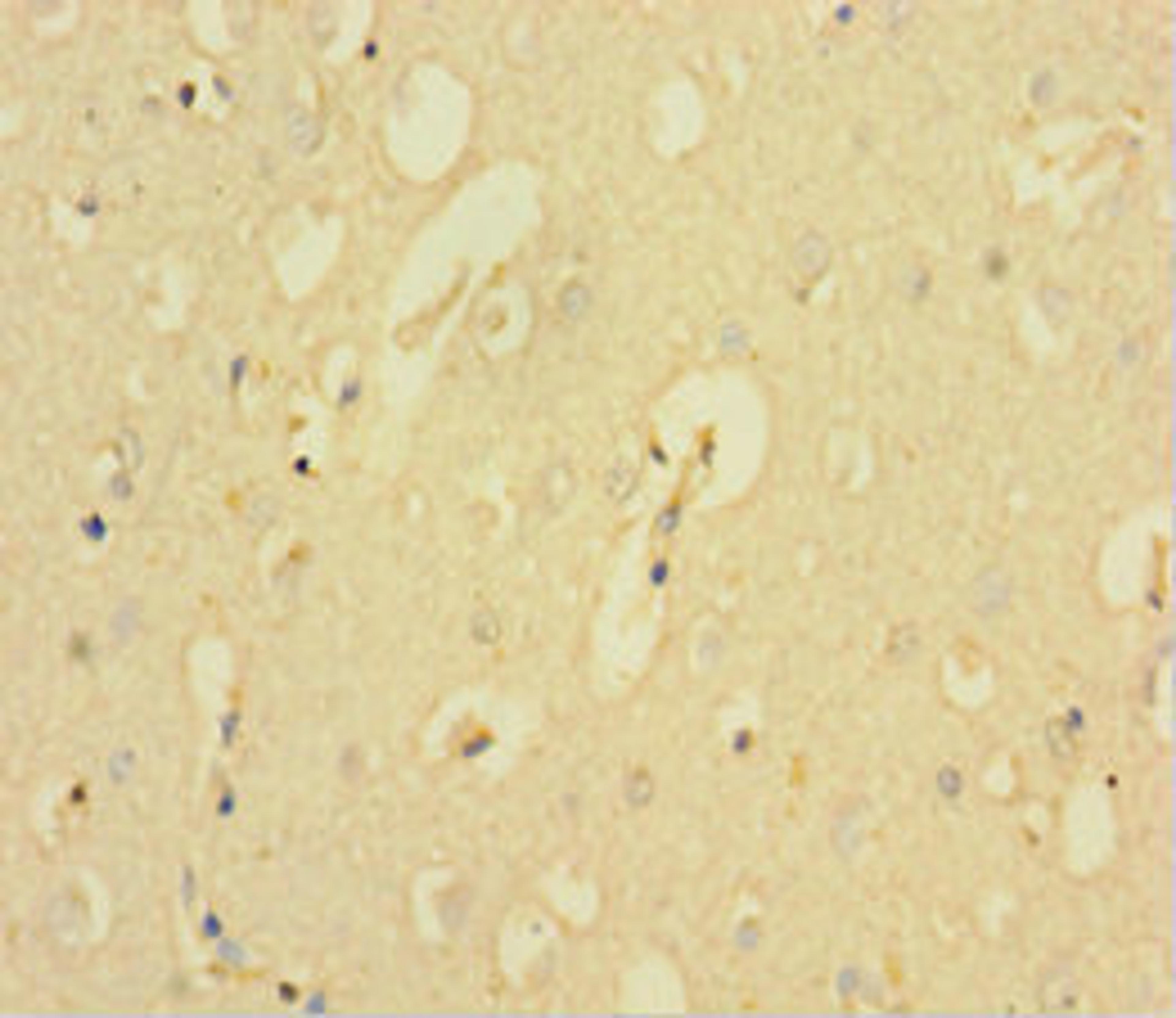 Immunohistochemistry of paraffin-embedded human brain tissue using CSB-PA614255LA01HU at dilution of 1:100
