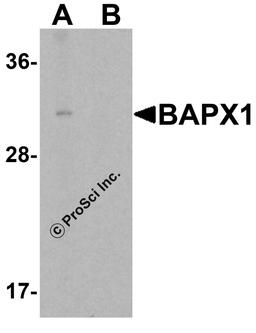 Western blot analysis of BAPX1 in human brain tissue lysate with BAPX1 antibody at 1 μg/mL in (A) the absence and (B) the presence of blocking peptide.