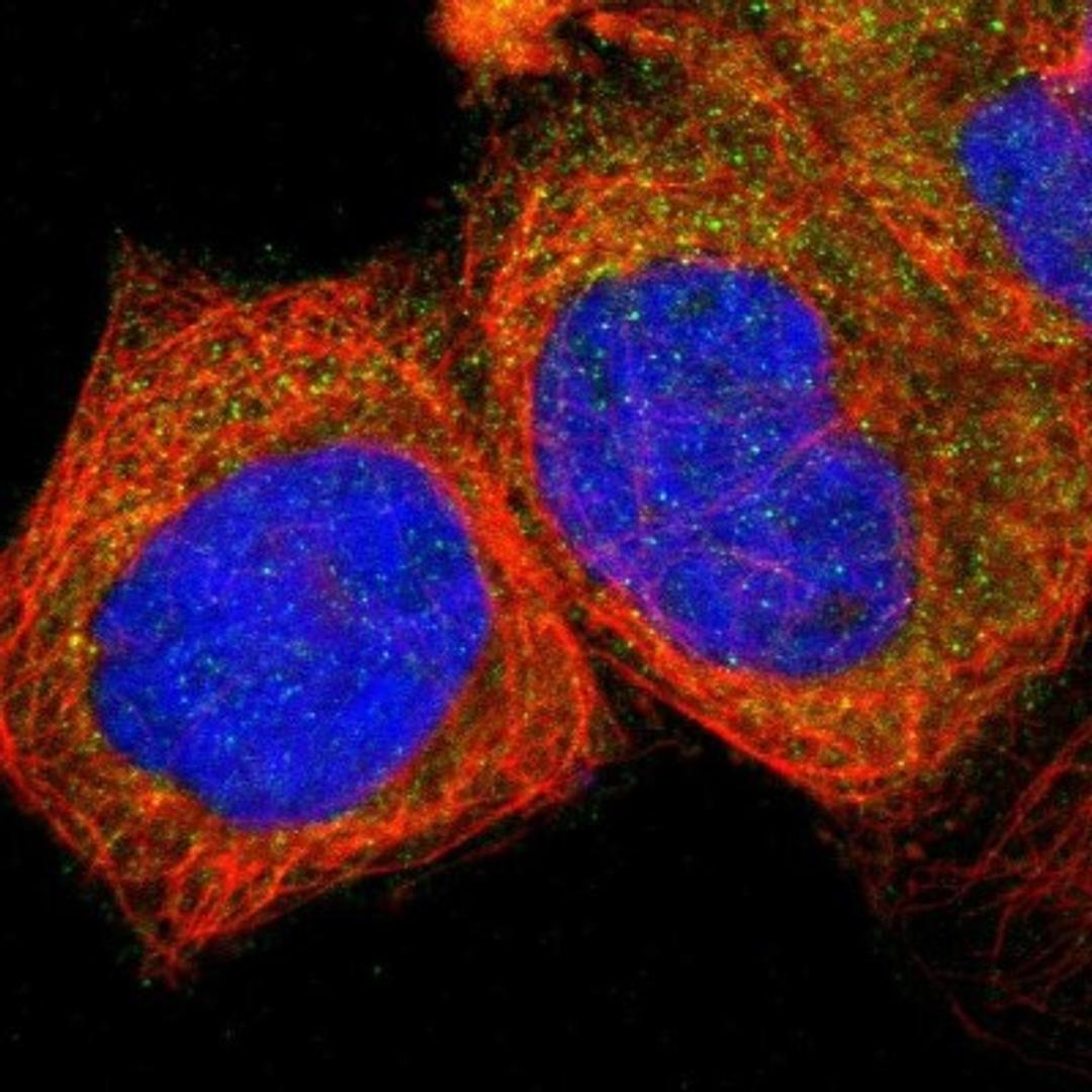 Immunocytochemistry/Immunofluorescence: TCN2 Antibody [NBP1-84317] - Staining of human cell line A-431 shows positivity in cytoplasm.