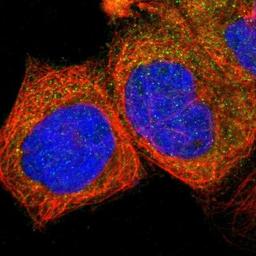 Immunocytochemistry/Immunofluorescence: TCN2 Antibody [NBP1-84317] - Staining of human cell line A-431 shows positivity in cytoplasm.