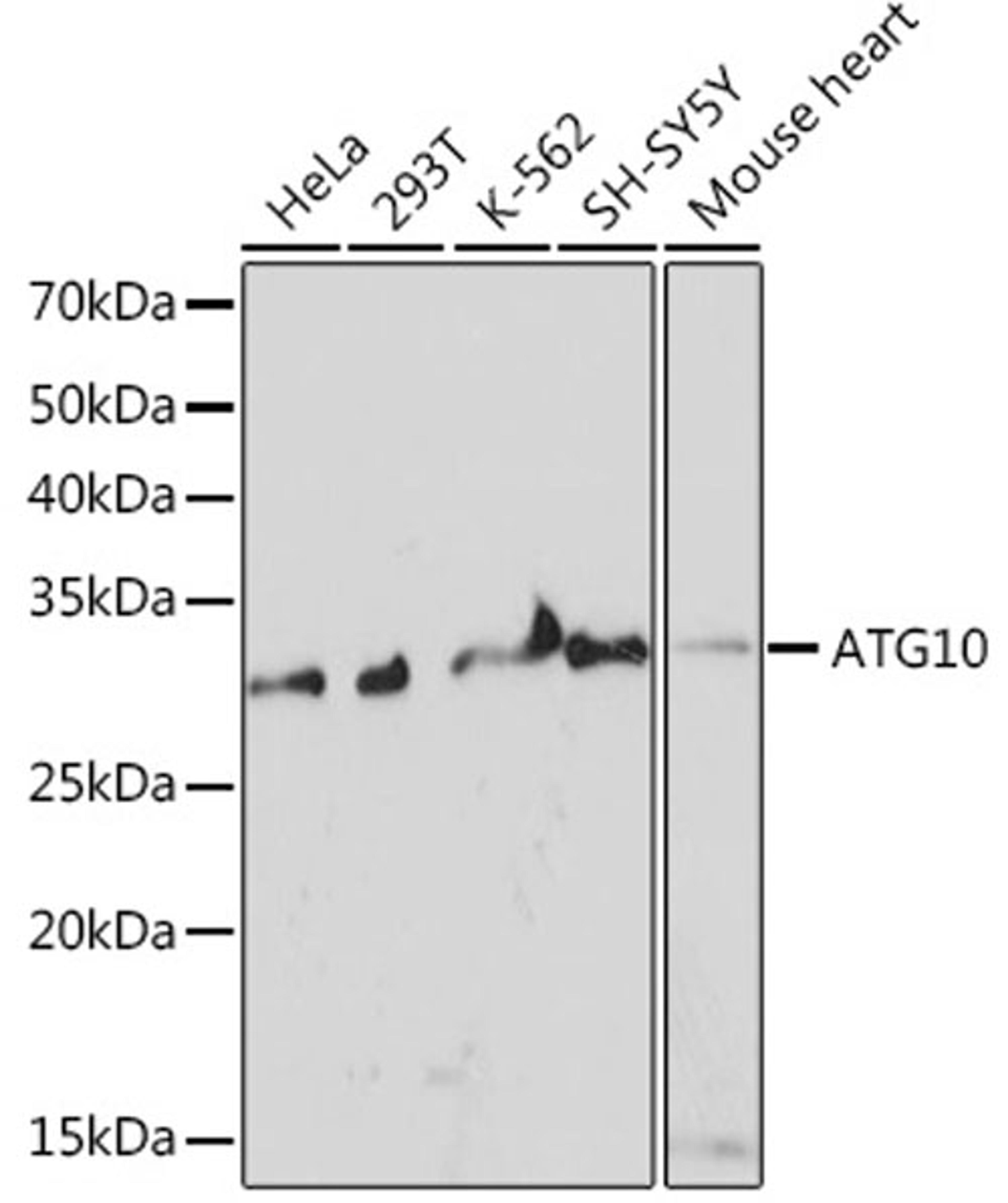 Western blot - ATG10 Rabbit mAb (A6848)