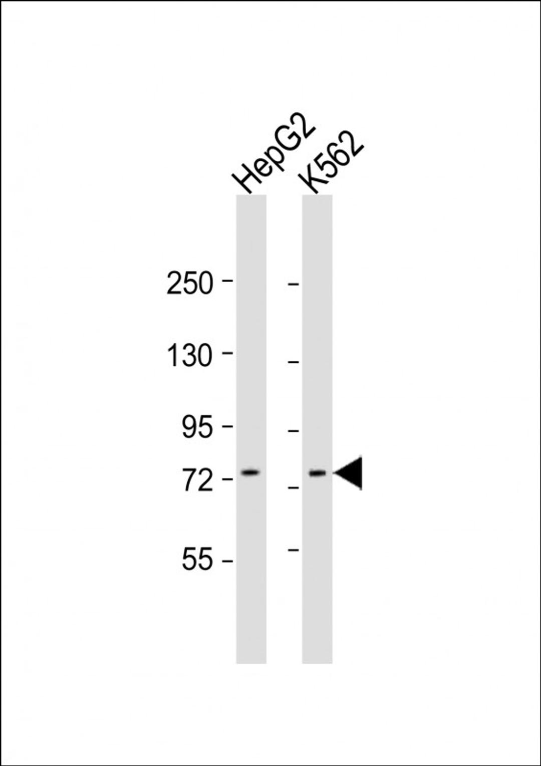 Western Blot at 1:1000 dilution Lane 1: HepG2 whole cell lysate Lane 2: K562 whole cell lysate Lysates/proteins at 20 ug per lane.