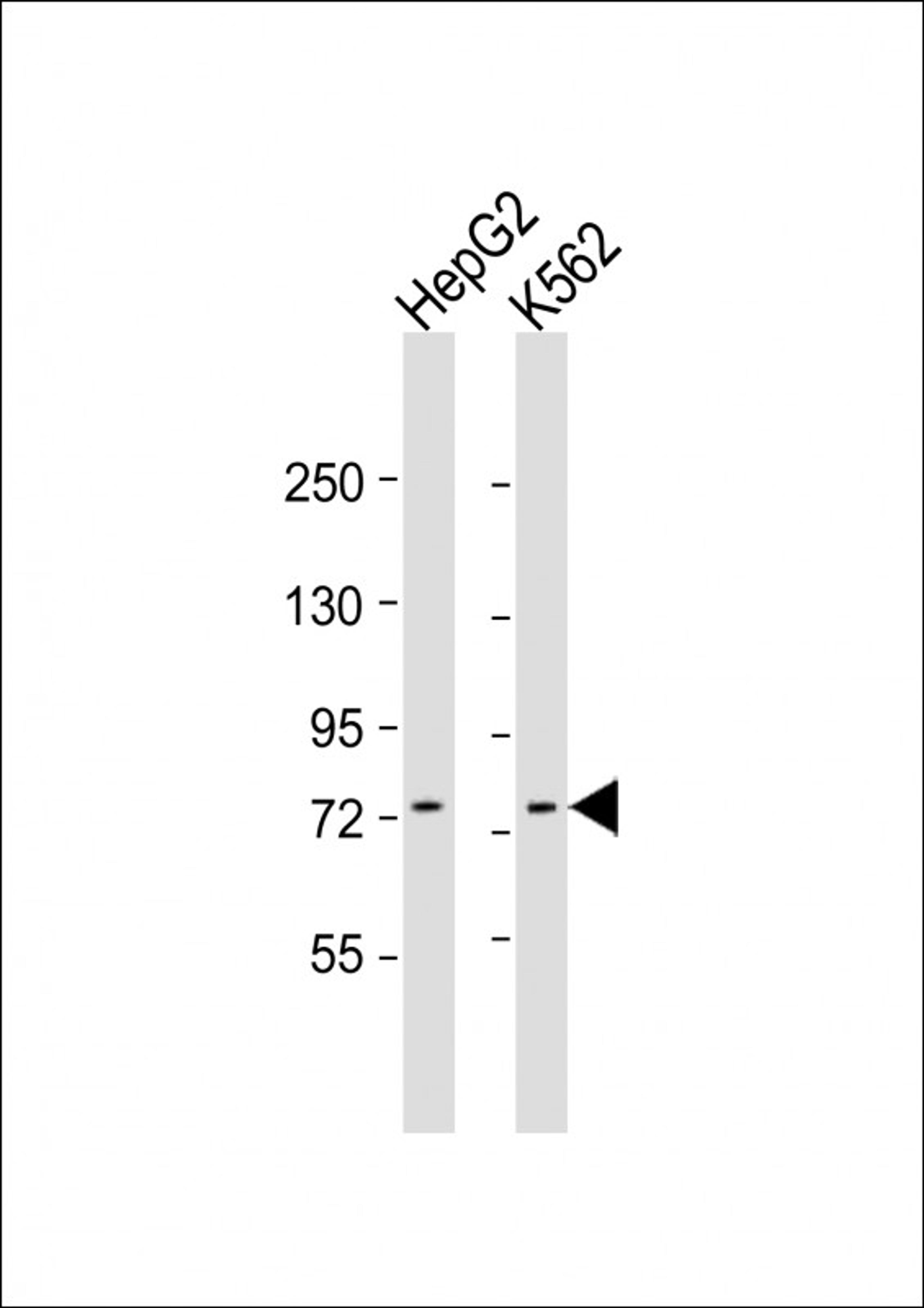 Western Blot at 1:1000 dilution Lane 1: HepG2 whole cell lysate Lane 2: K562 whole cell lysate Lysates/proteins at 20 ug per lane.