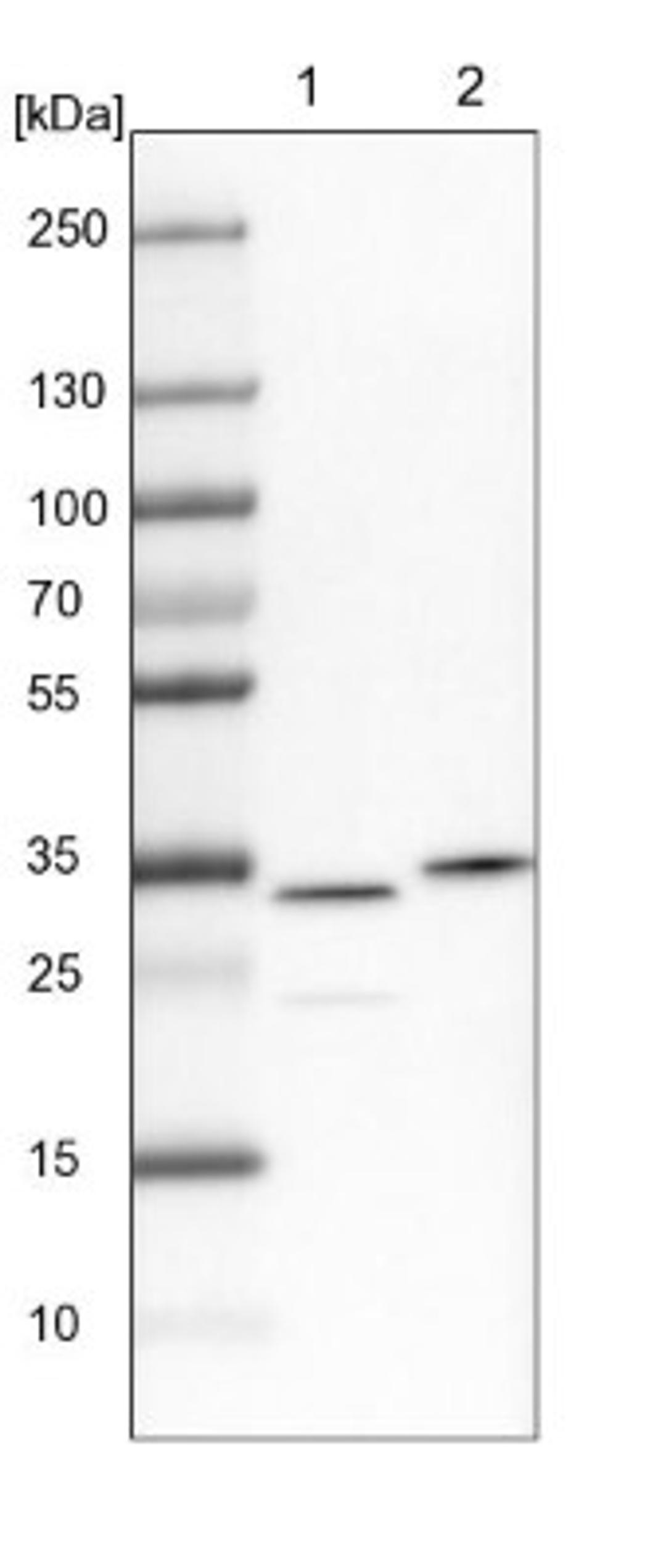 Western Blot: CKAP1 Antibody [NBP1-85671] - Lane 1: NIH-3T3 cell lysate (Mouse embryonic fibroblast cells)<br/>Lane 2: NBT-II cell lysate (Rat Wistar bladder tumour cells)