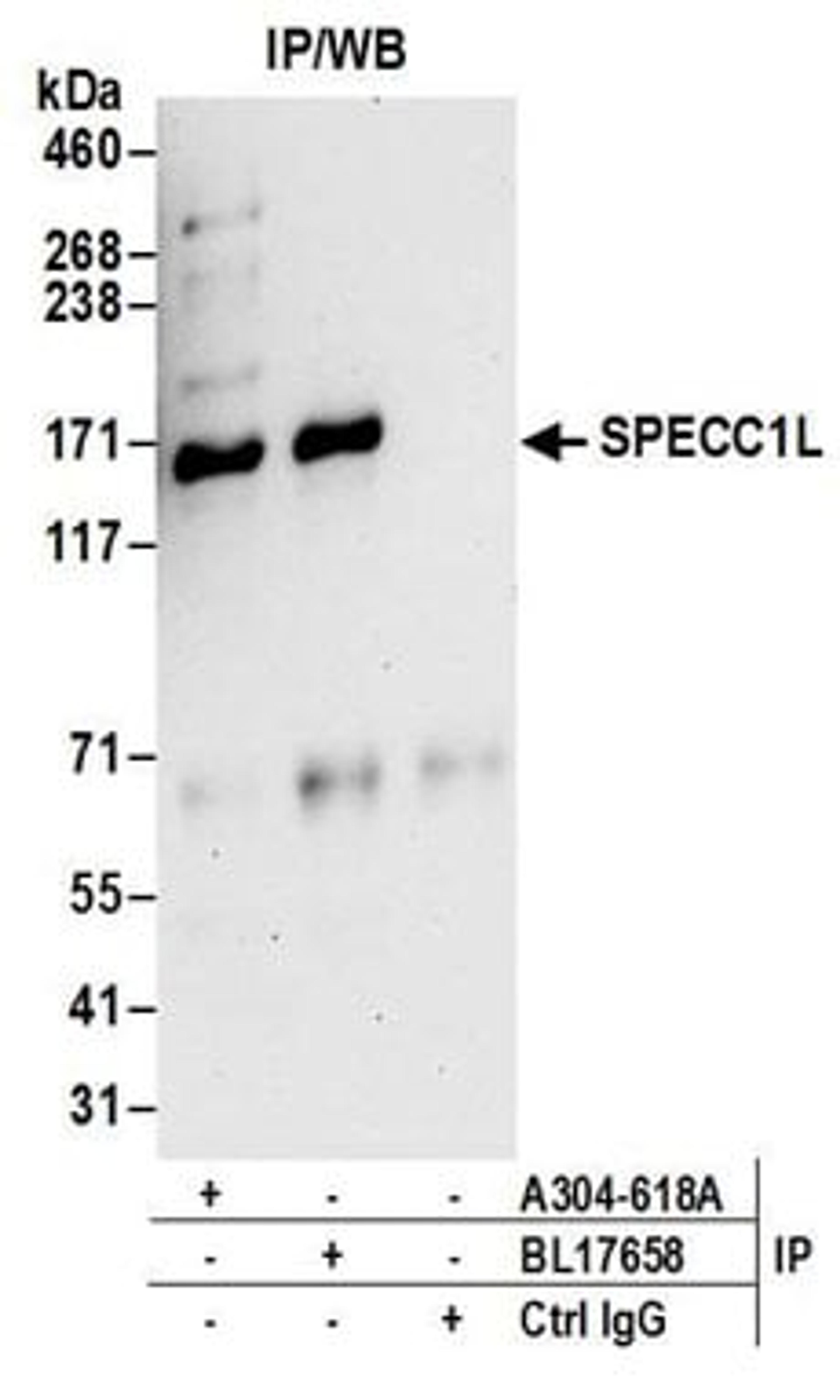 Detection of human SPECC1L by western blot of immunoprecipitates.