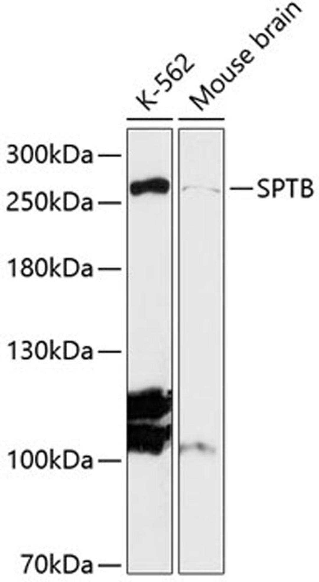 Western blot - SPTB antibody (A13048)