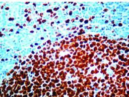 Immunohistochemistry-Paraffin: Ki-67/MKI67 Antibody (SP6) [NB600-1252] - Formalin fixed paraffin embedded human tonsil stained with Ki-67 antibody.