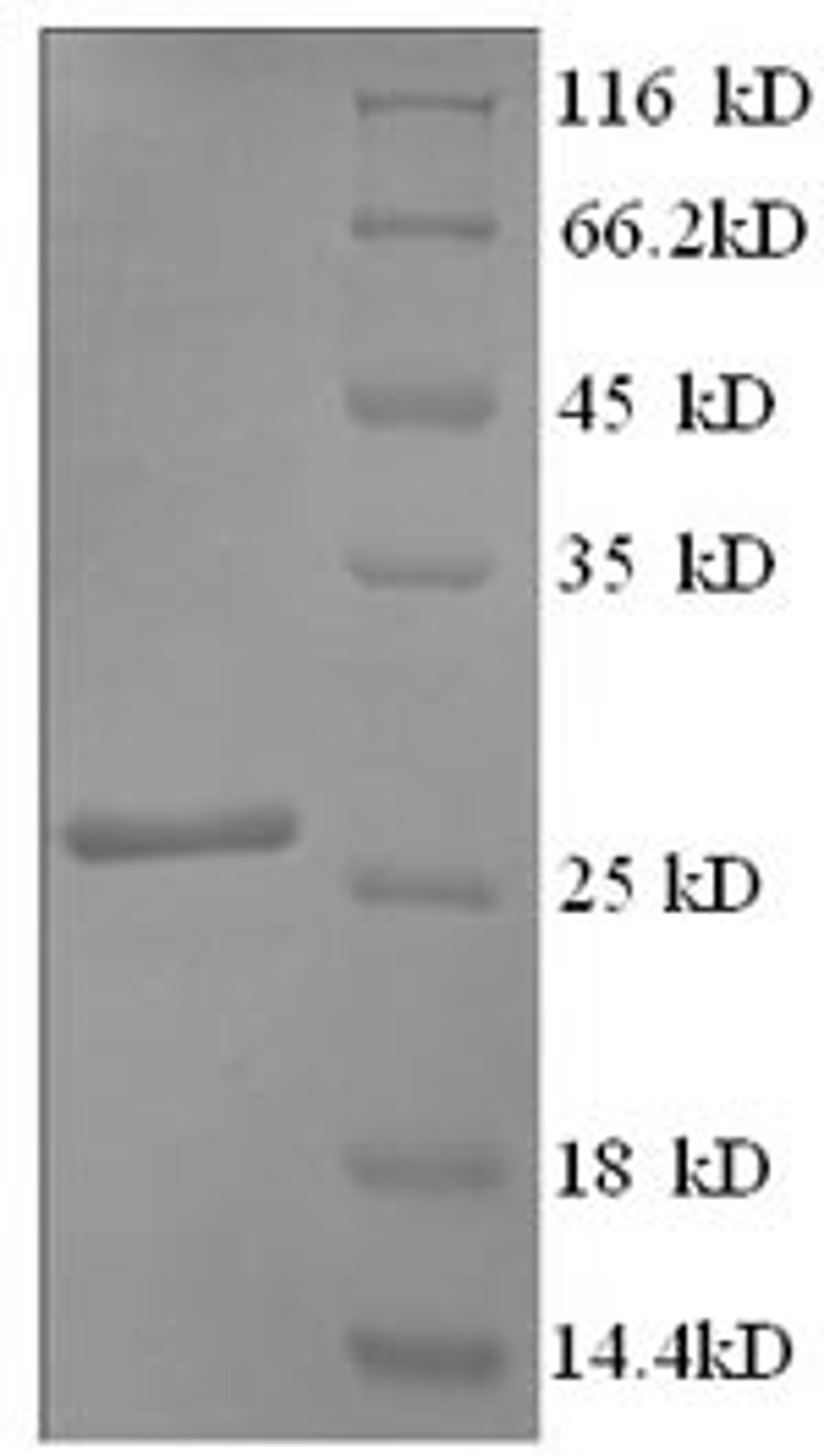 (Tris-Glycine gel) Discontinuous SDS-PAGE (reduced) with 5% enrichment gel and 15% separation gel.