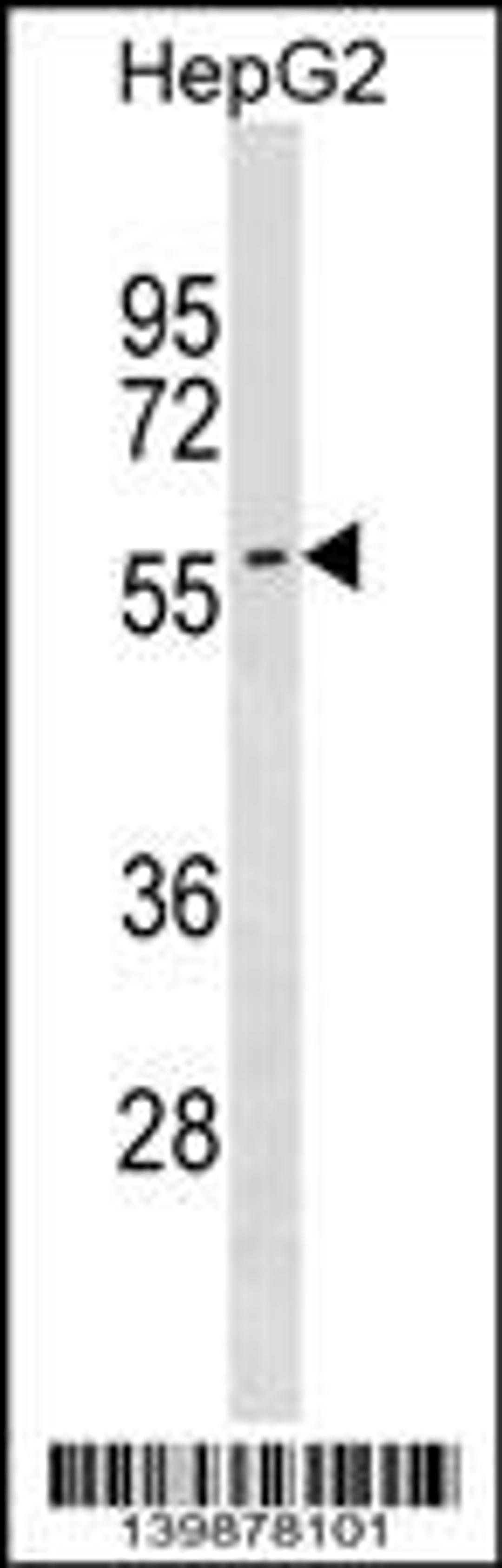 Western blot analysis in HepG2 cell line lysates (35ug/lane).