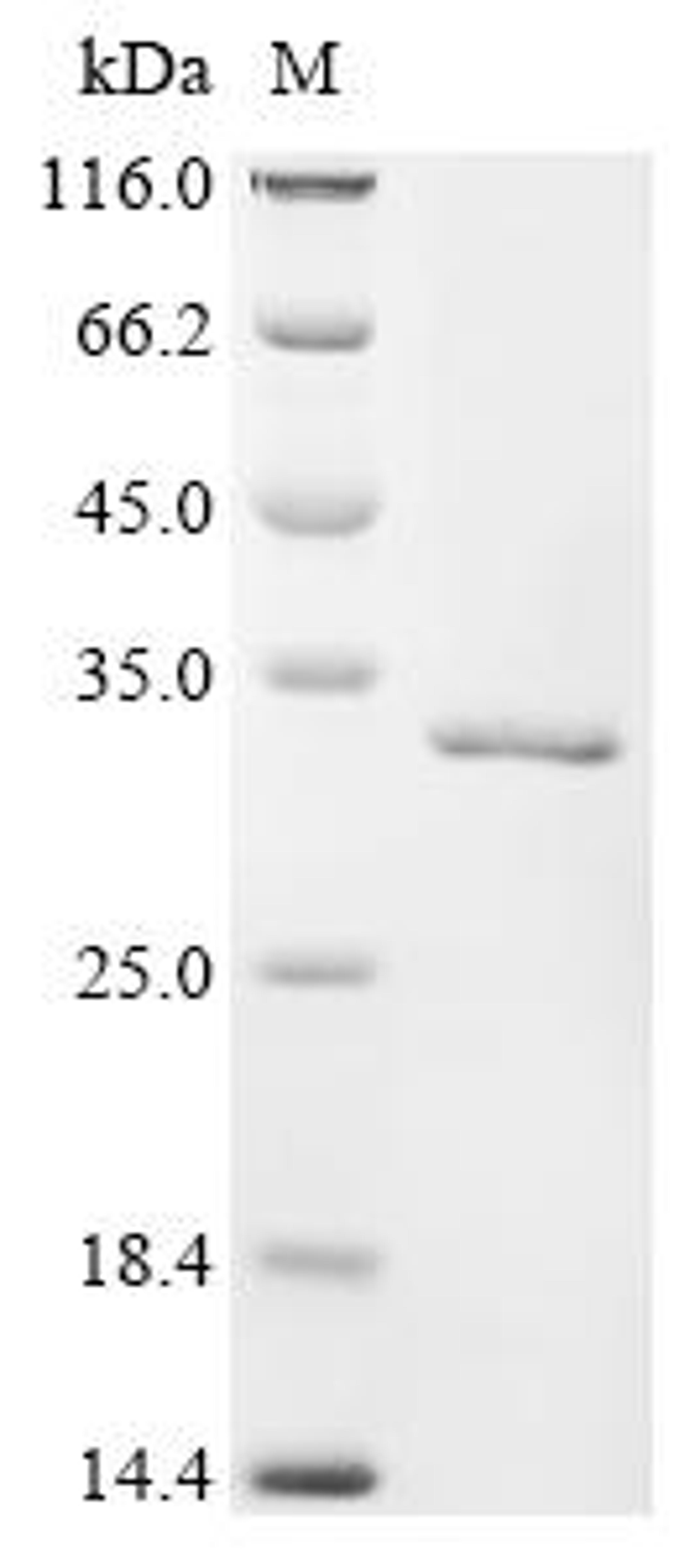 (Tris-Glycine gel) Discontinuous SDS-PAGE (reduced) with 5% enrichment gel and 15% separation gel.