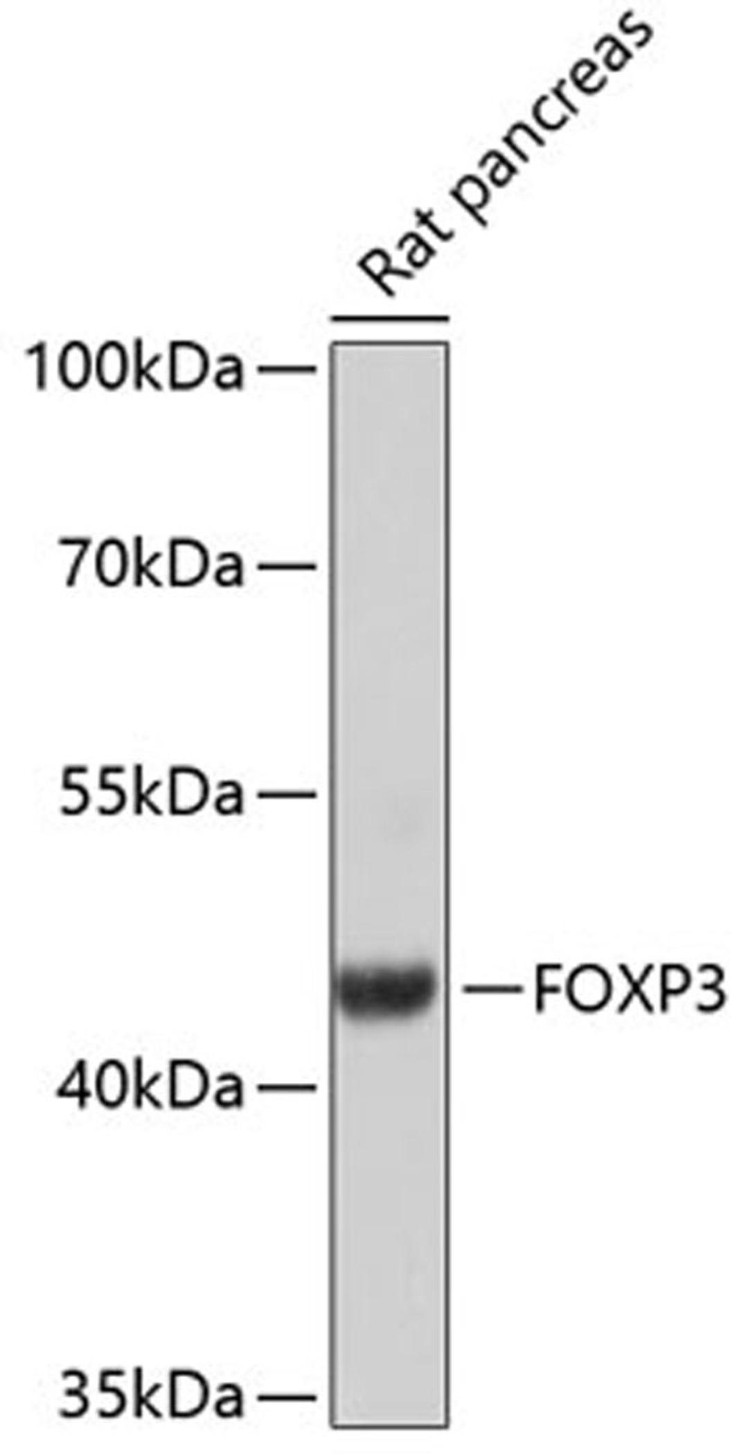 Western blot - FOXP3 antibody (A12051)