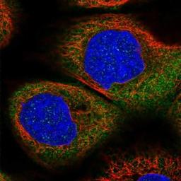 Immunocytochemistry/Immunofluorescence: DHX29 Antibody [NBP1-85271] - Staining of human cell line A-431 shows positivity in cytoplasm.