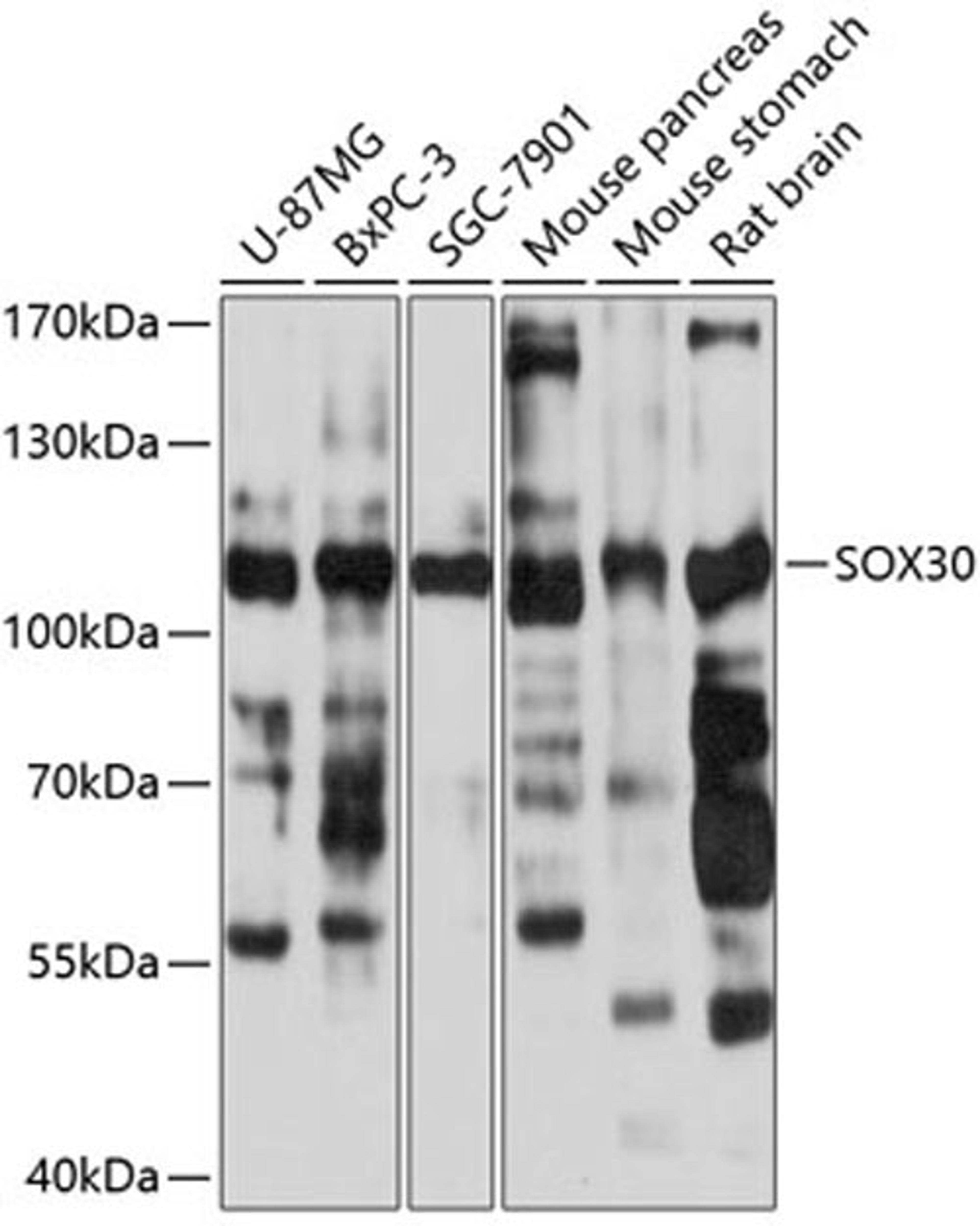 Western blot - SOX30 antibody (A11759)