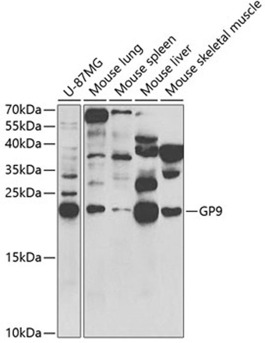 Western blot - GP9 antibody (A5374)