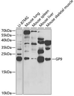 Western blot - GP9 antibody (A5374)