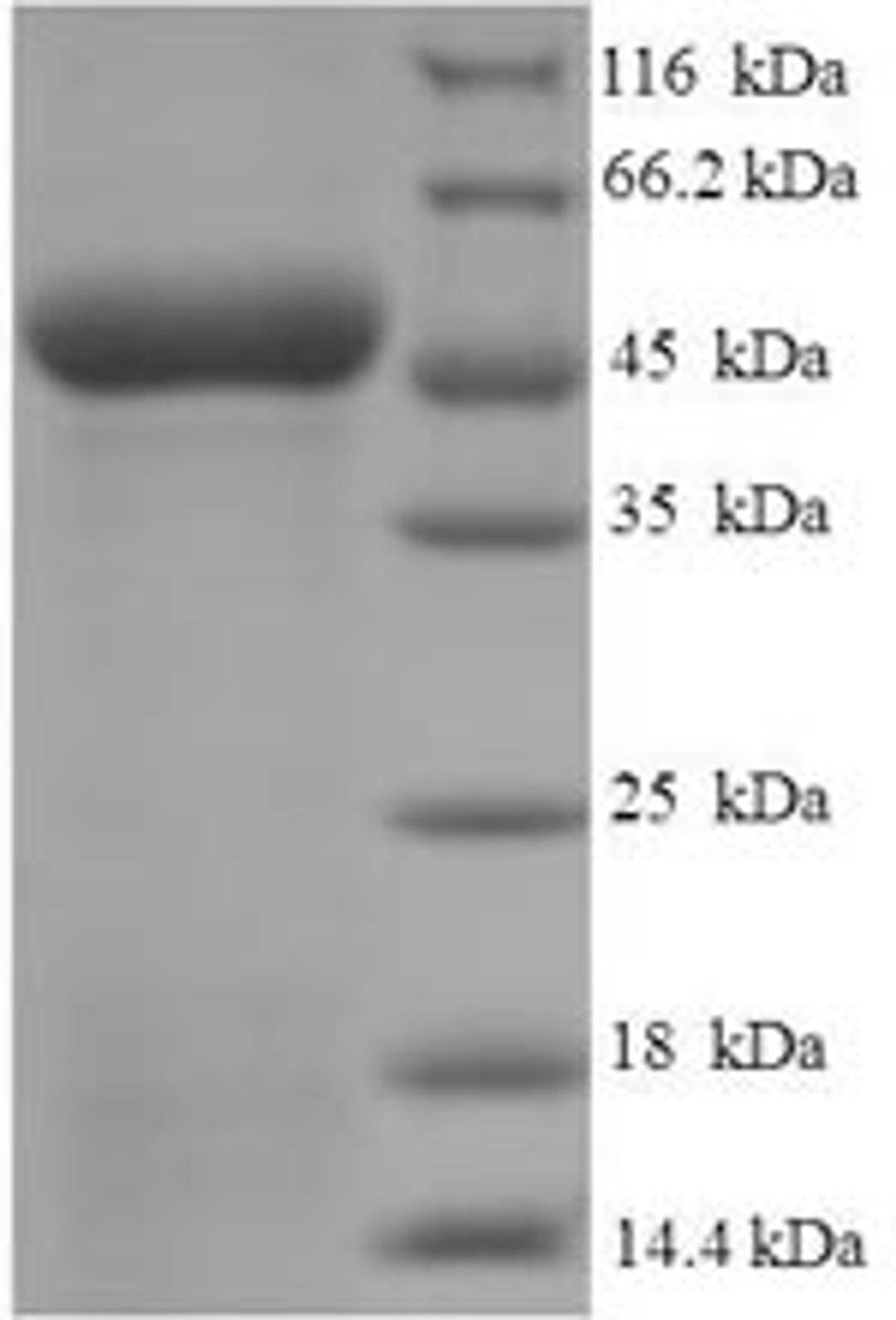 (Tris-Glycine gel) Discontinuous SDS-PAGE (reduced) with 5% enrichment gel and 15% separation gel.
