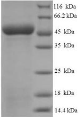 (Tris-Glycine gel) Discontinuous SDS-PAGE (reduced) with 5% enrichment gel and 15% separation gel.