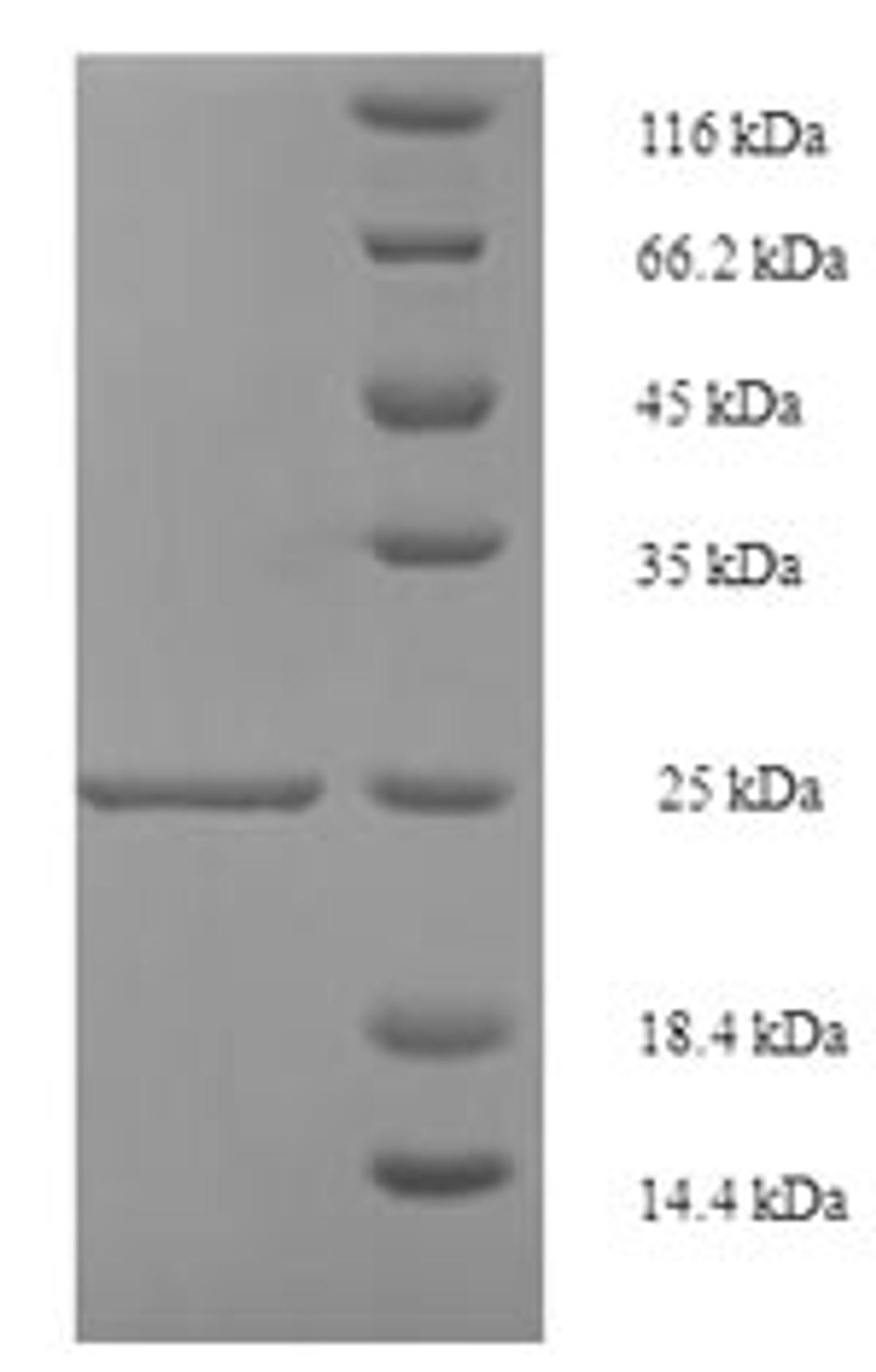 (Tris-Glycine gel) Discontinuous SDS-PAGE (reduced) with 5% enrichment gel and 15% separation gel.