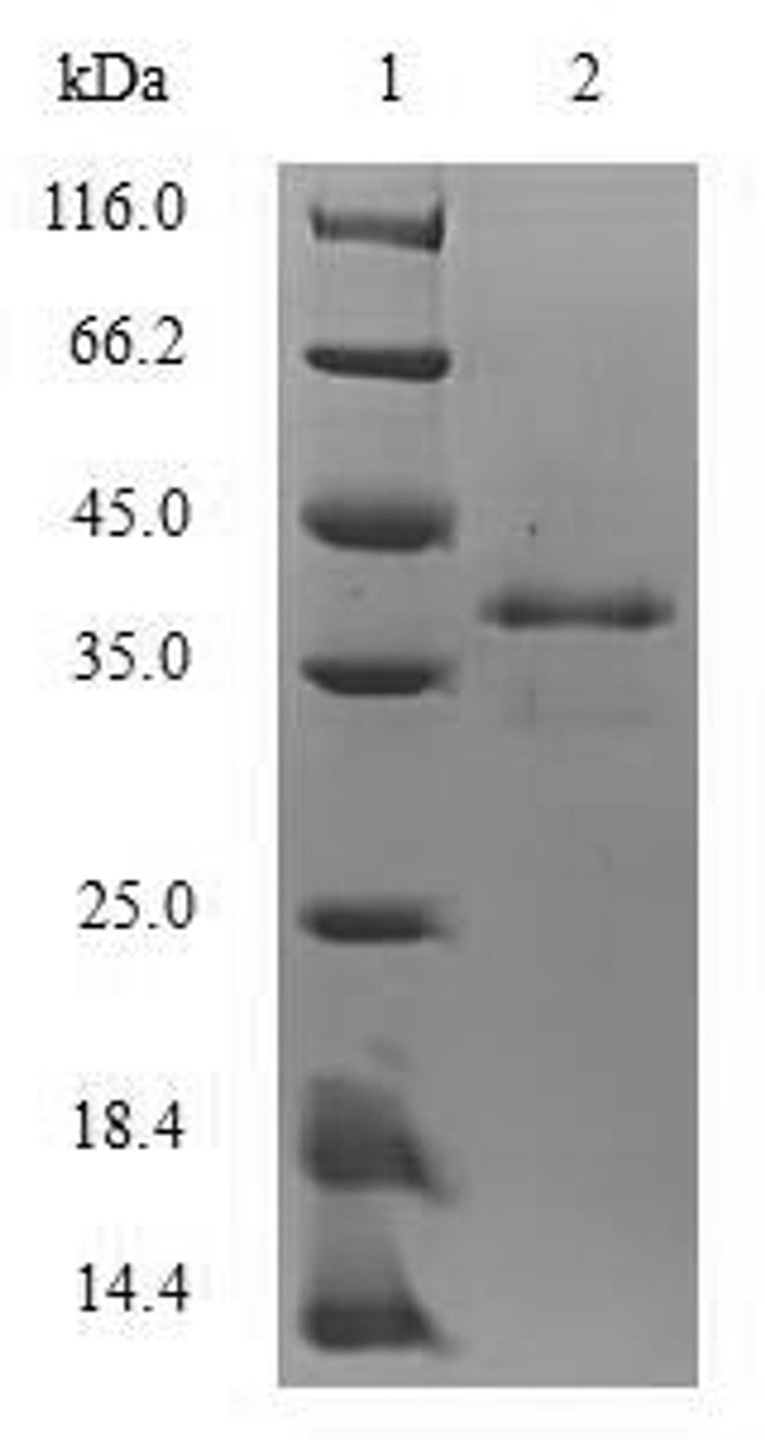 (Tris-Glycine gel) Discontinuous SDS-PAGE (reduced) with 5% enrichment gel and 15% separation gel.