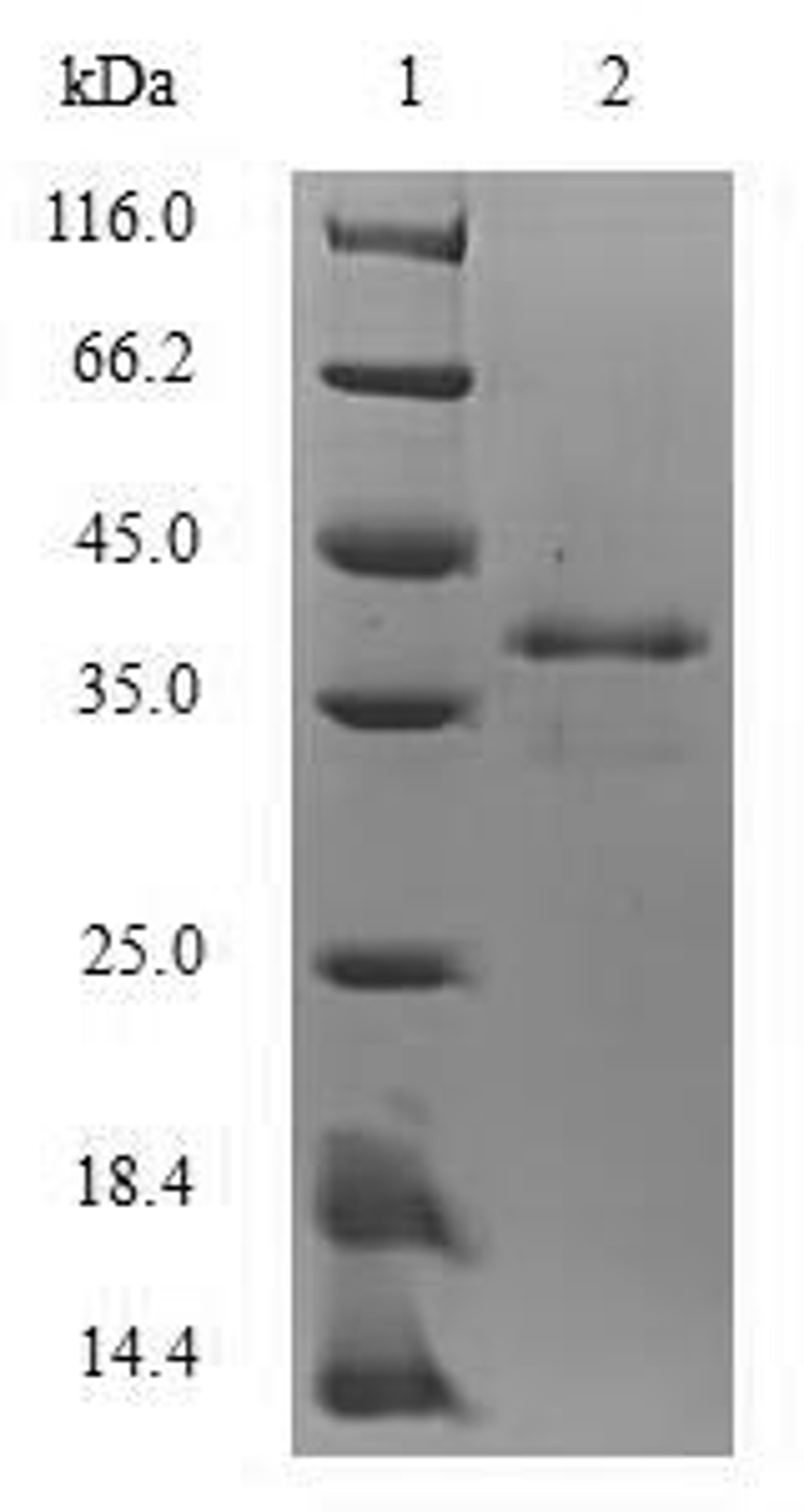 (Tris-Glycine gel) Discontinuous SDS-PAGE (reduced) with 5% enrichment gel and 15% separation gel.