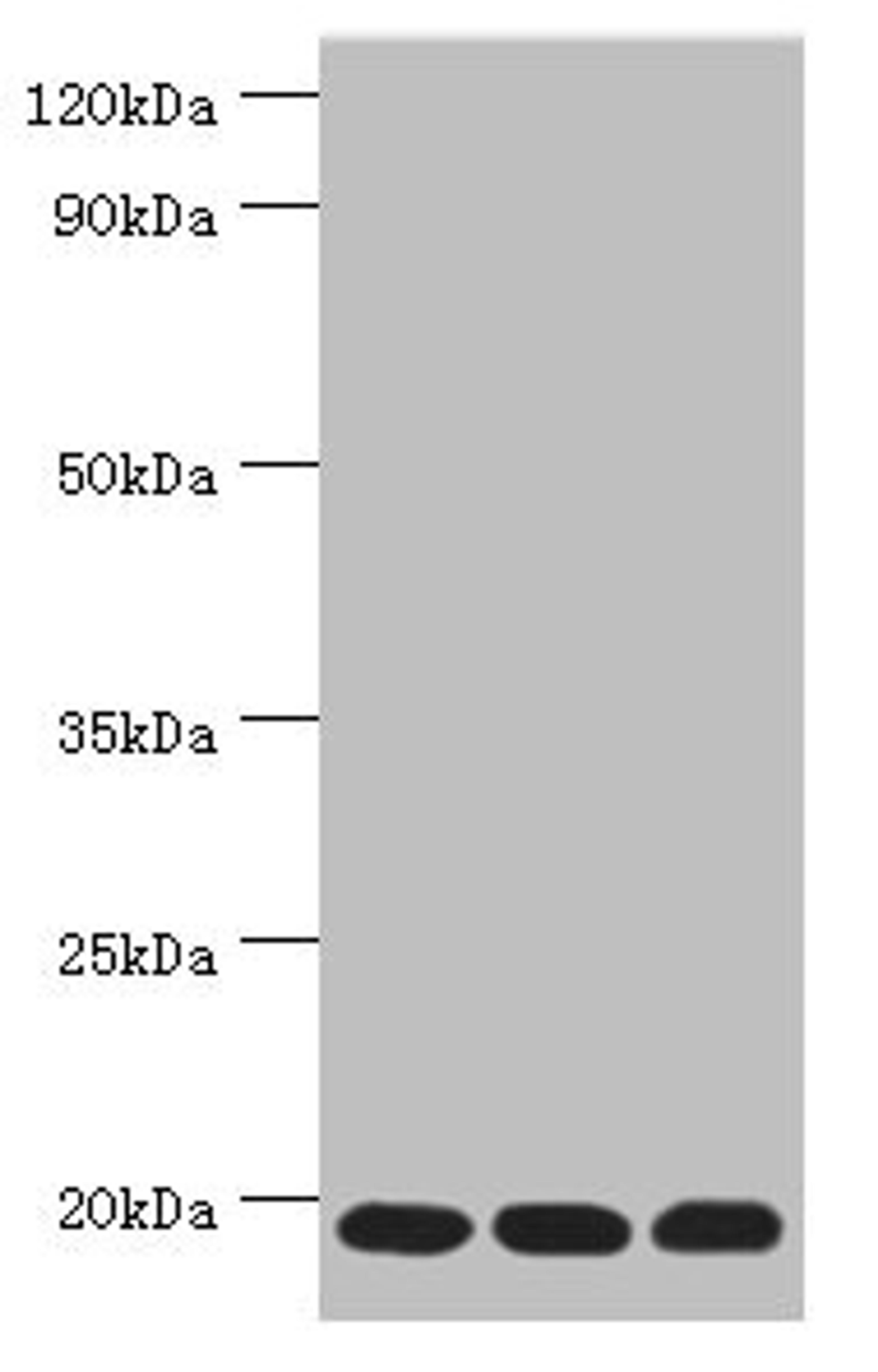 Western blot. All lanes: Thioredoxin, mitochondrial antibody at 3ug/ml. Lane 1: Mouse liver tissue. Lane 2: Rat brain tissue. Lane 3: Mouse kidney tissue. Secondary. Goat polyclonal to rabbit IgG at 1/10000 dilution. Predicted band size: 18 kDa. Observed band size: 18 kDa.