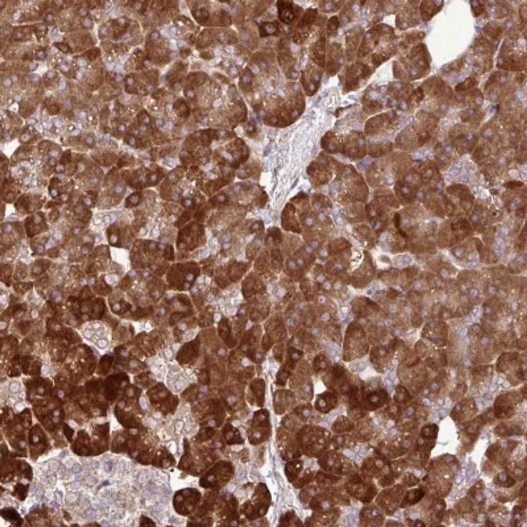 Immunohistochemistry: DLGAP4 Antibody [NBP2-33271] - Immunohistochemical staining of human pancreas shows strong cytoplasmic positivity in exocrine glandular cells.