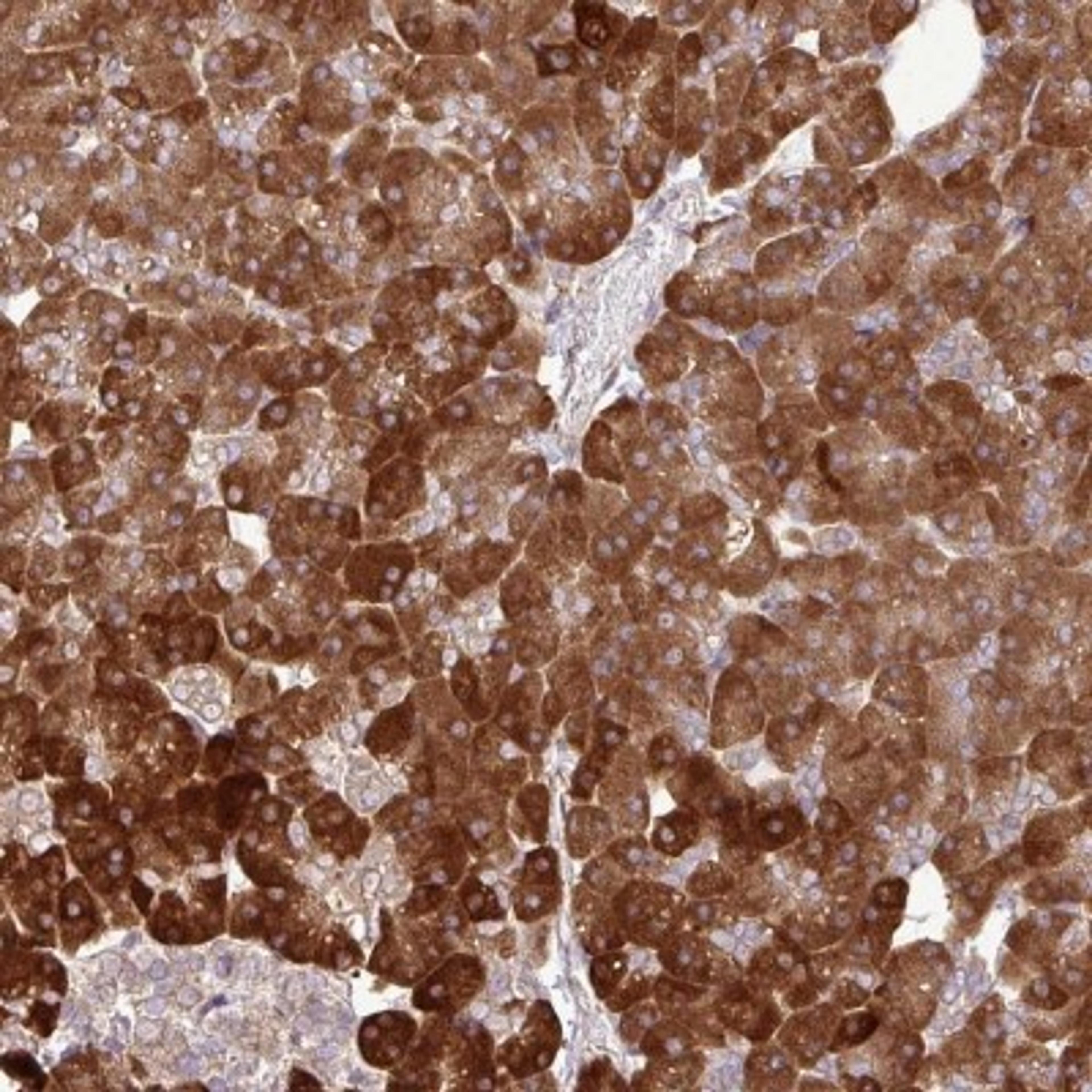 Immunohistochemistry: DLGAP4 Antibody [NBP2-33271] - Immunohistochemical staining of human pancreas shows strong cytoplasmic positivity in exocrine glandular cells.