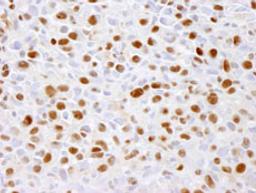 Detection of mouse phospho-MCM2 (Ser 41) by immunohistochemistry.