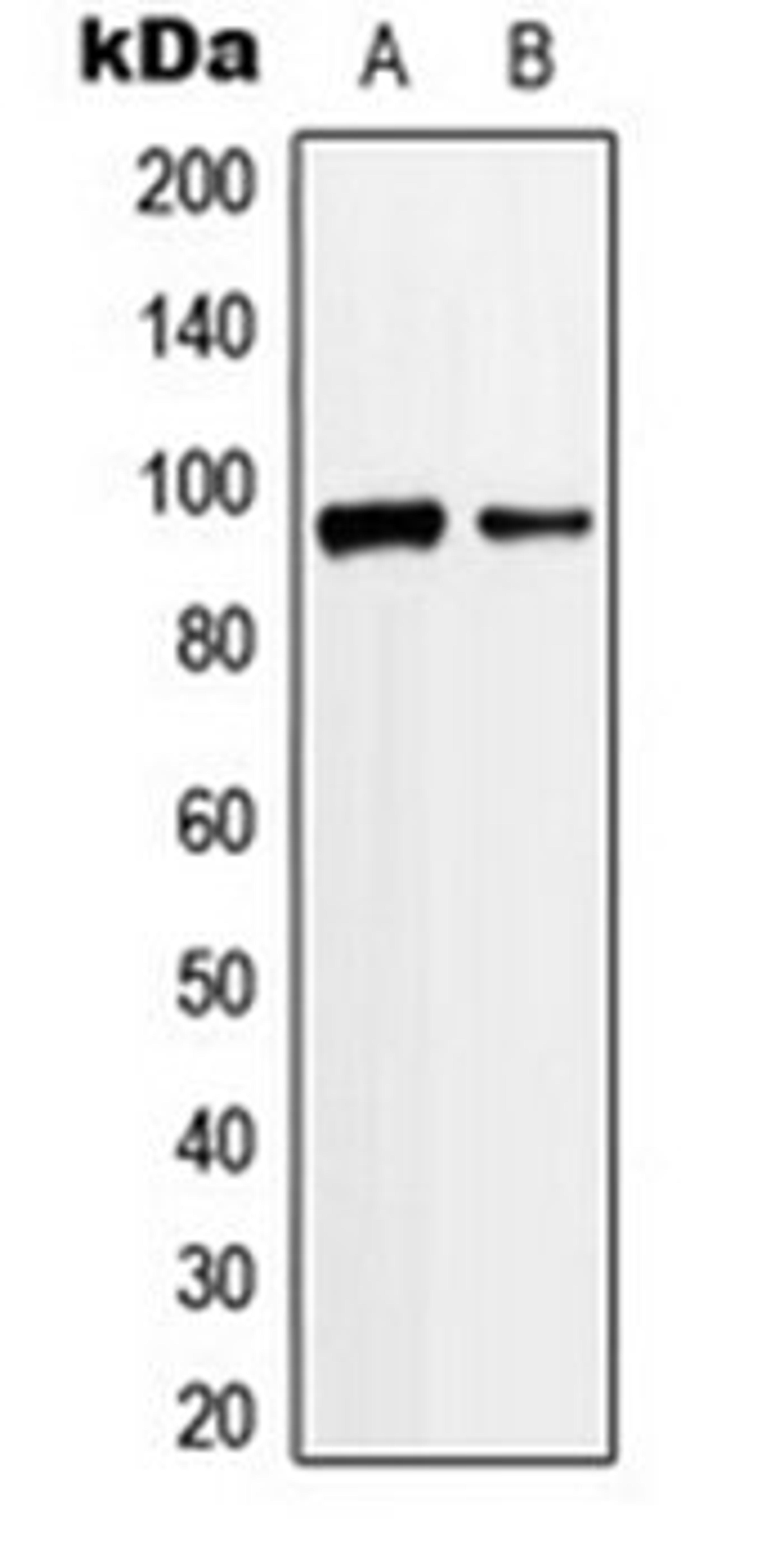 Western blot analysis of Jurkat (Lane 1), K562 (Lane 2) whole cell lysates using ANKRD20A3 antibody