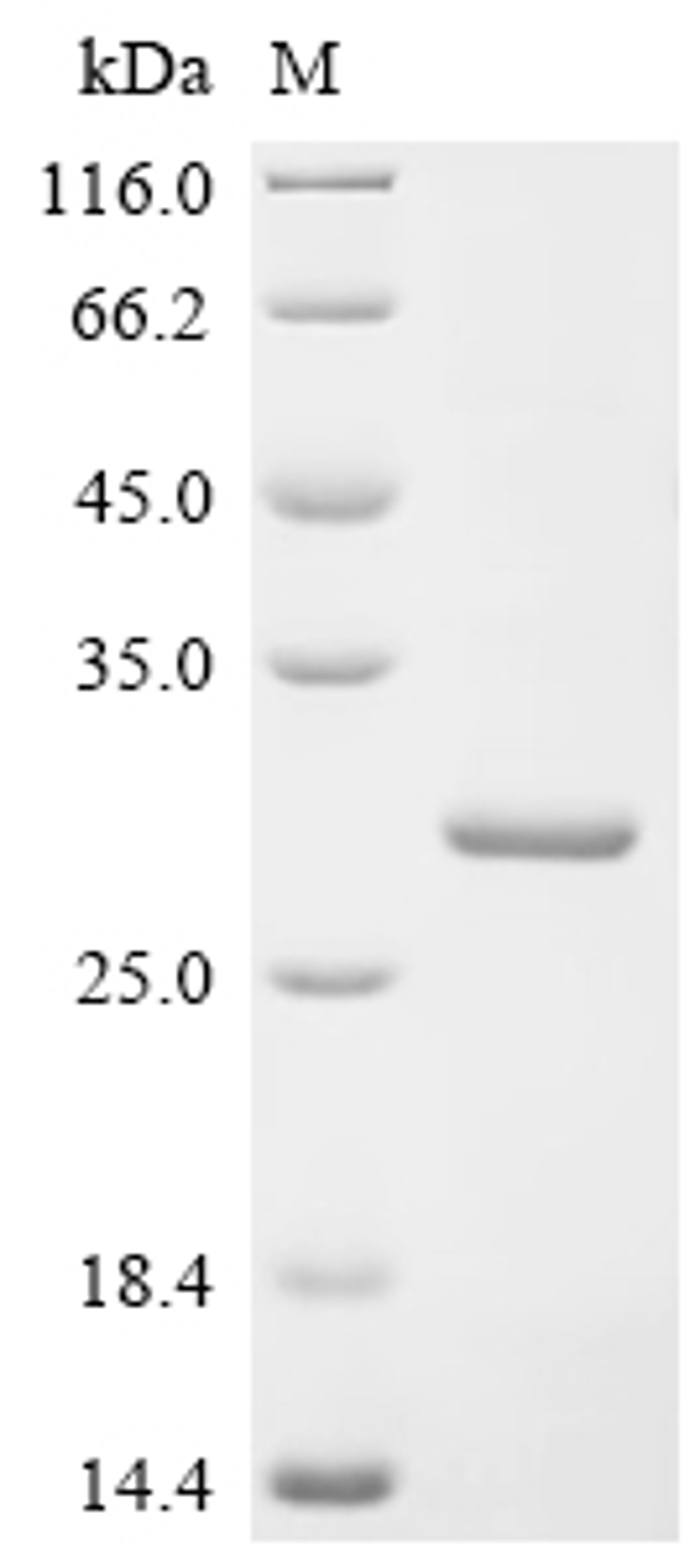 (Tris-Glycine gel) Discontinuous SDS-PAGE (reduced) with 5% enrichment gel and 15% separation gel.