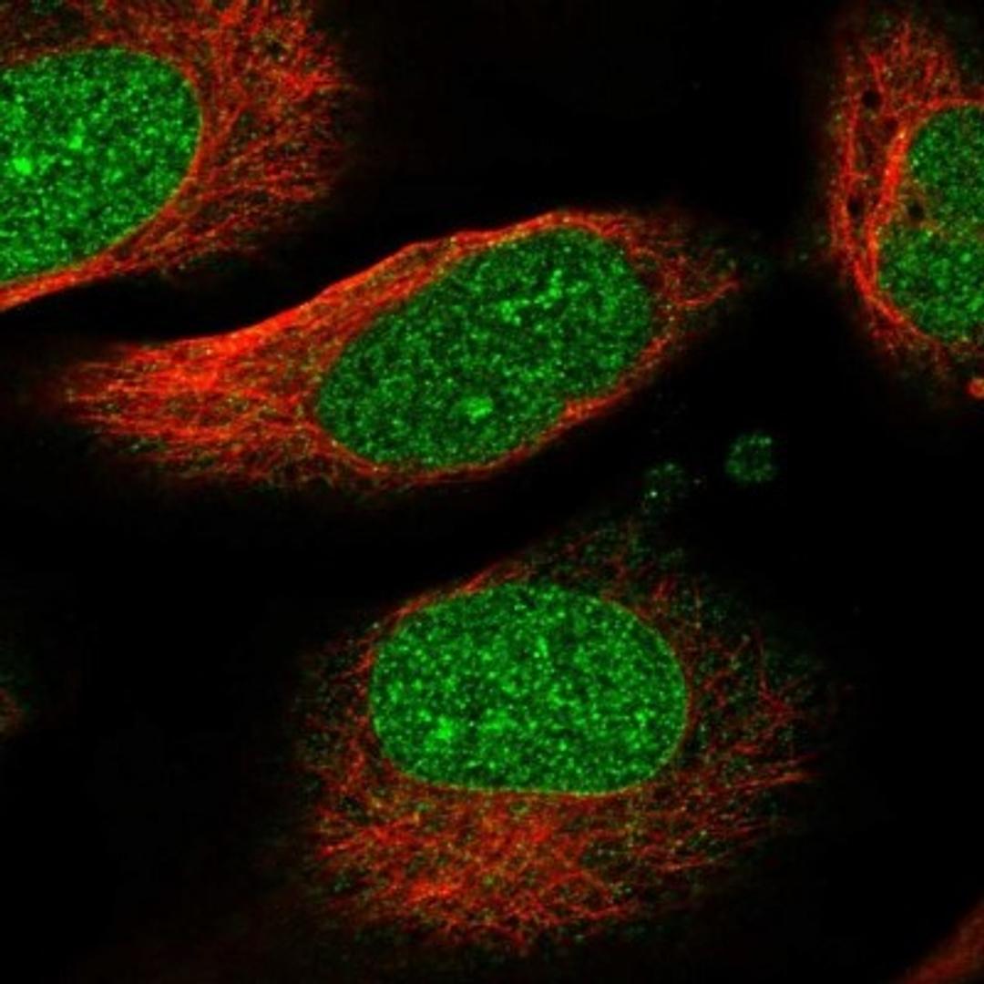 Immunocytochemistry/Immunofluorescence: FAM76B Antibody [NBP2-32670] - Immunofluorescent staining of human cell line U-2 OS shows positivity in nucleus & nuclear membrane. Antibody staining is shown in green.